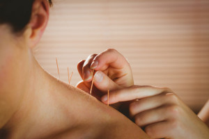 acupuncture-shoulder